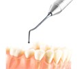 Fabri 1303-1,5F Black - узкая гладилка с двухугловым штопфером-шариком Ø1.5mm, эргономичная ручка Ø10mm, покрытие Black 1303-1,5F Black - фото 496730