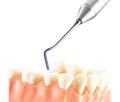 Fabri 1303-1,5F Black - узкая гладилка с двухугловым штопфером-шариком Ø1.5mm, эргономичная ручка Ø10mm, покрытие Black 1303-1,5F Black - фото 496731