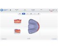 Shining 3D Aoralscan 3 - интраоральный сканер 023835 - фото 499256