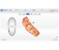 Shining 3D Aoralscan 3 - интраоральный сканер 023835 - фото 499257