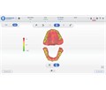 Shining 3D Aoralscan 3 - интраоральный сканер 023835 - фото 499258
