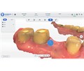 Shining 3D Aoralscan 3 - интраоральный сканер 023835 - фото 499259