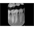 Instrumentarium Focus Intraoral X-ray Imaging - рентгенологическое устройство для различных видов диагностики, размер M с длиной плеча 191 см 900986 M - фото 502054