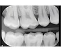 Instrumentarium Focus Intraoral X-ray Imaging - рентгенологическое устройство для различных видов диагностики, размер M с длиной плеча 191 см 900986 M - фото 502055
