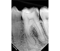 Eighteeth Nanopix 1 - интраоральный визиограф, влагозащищенный 031136 - фото 502138