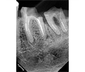 Eighteeth Nanopix 1 - интраоральный визиограф, влагозащищенный 031136 - фото 502139