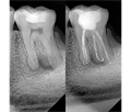Eighteeth Nanopix 1 - интраоральный визиограф, влагозащищенный 031136 - фото 502140