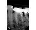 Eighteeth Nanopix 1 - интраоральный визиограф, влагозащищенный 031136 - фото 502141