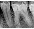 Carestream Dental RVG 5200 - радиовизиограф, 16 пар линий/мм 002778 - фото 502172