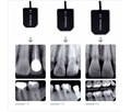 Vatech Комплект EzSensor и DX-3000 - высокочастотный портативный дентальный рентген с визиографом 020014 - фото 502194