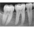 Dentsply Sirona XIOS XG SUPREME USB MODUL - модульная сенсорная система со сменным кабелем 005075 - фото 502204