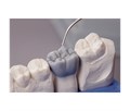Renfert GEO Crowax - воск зеленый, моделировочный, прозрачный, среднетвёрдый, 80 г 475-0100 - фото 512843