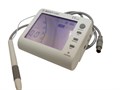 Апекслокатор COXO C-ROOT I (VI) nyOP22n4i21GyFqEaadVn3 - фото 524620